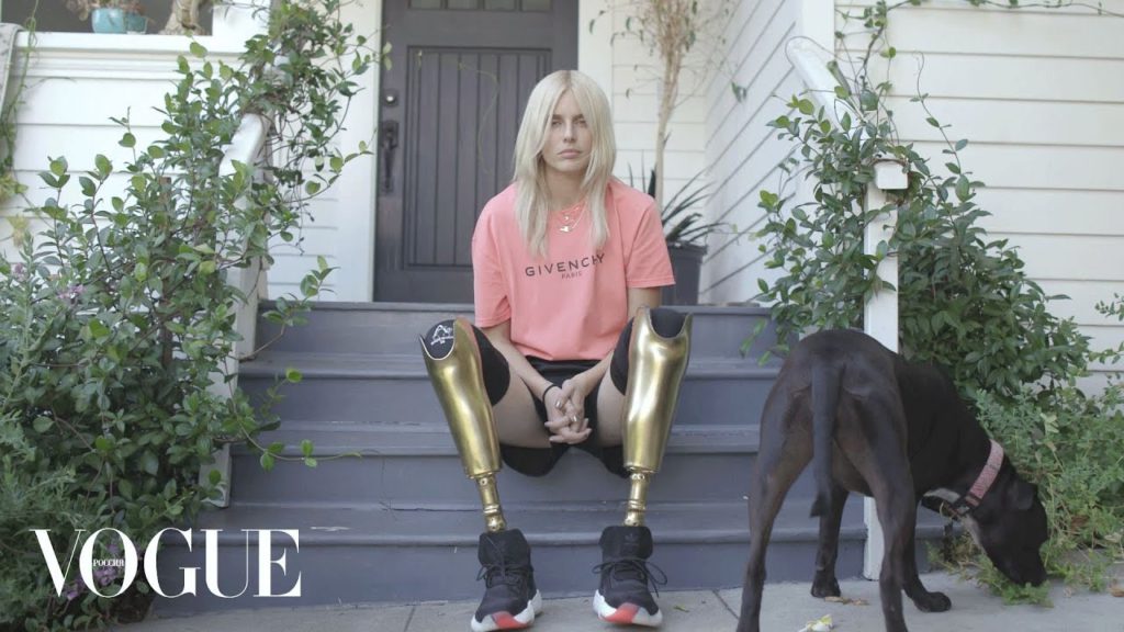 Lauren Wasser – příběh modelky se zlatýma nohama